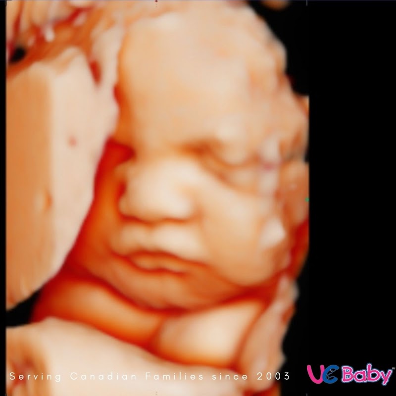 Exterior of UC Baby 3D Ultrasound - 5D Ultrasound